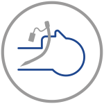 Potential Clinical Consequences Residual Neuromuscular Blockade